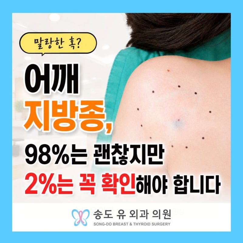 어깨 지방종, 98%는 괜찮지만 2%는 꼭 확인해야 합니다.