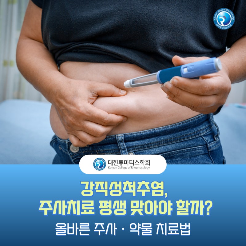 강직성 척추염, 주사치료 평생 맞아야 할까? '강직성 척추염' 올바른 주사 · 약물 치료법