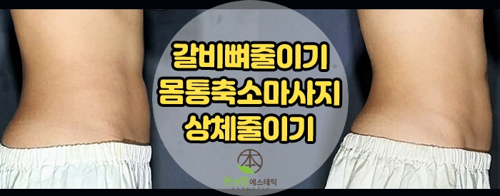 벌어진흉곽,늑골,갈비뼈줄이는 몸통축소마사지! 잠실체형관리 본앤영에서!
