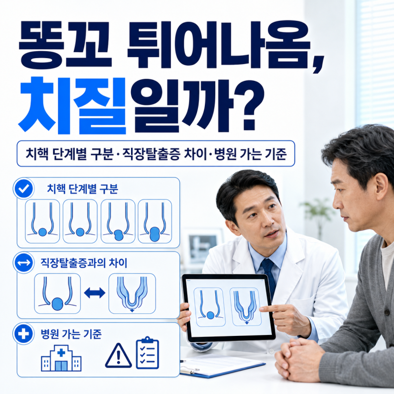 똥꼬 튀어나옴, 치질일까? | 치핵 단계별 구분·직장탈출증 차이·병원 가는 기준