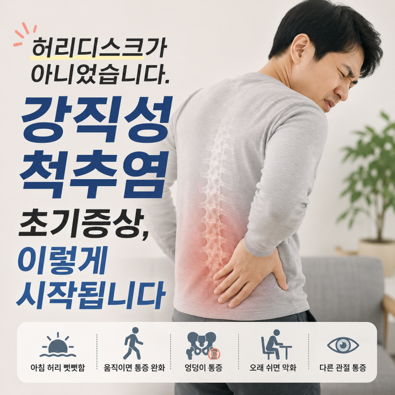허리디스크가 아니었습니다. 강직성 척추염 초기증상, 이렇게 시작됩니다