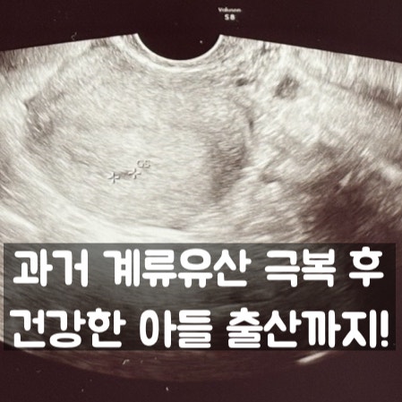 [유산 후 재임신①] 과거 계류유산 극복 후 건강한 출산 | 계류유산 증상·유산 후 회복·소파....