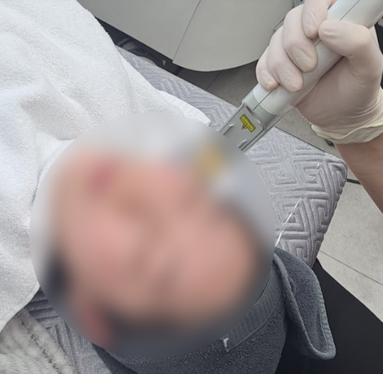청주시피부과, 얼굴 홍조가 쉽게 가라앉지 않는 이유 I 진료과목 피부과