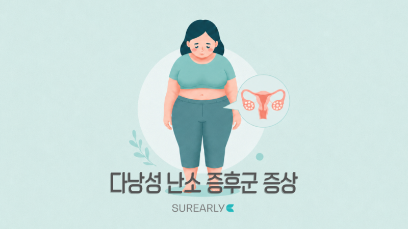 다낭성 난소 증후군 증상 체크리스트 총정리