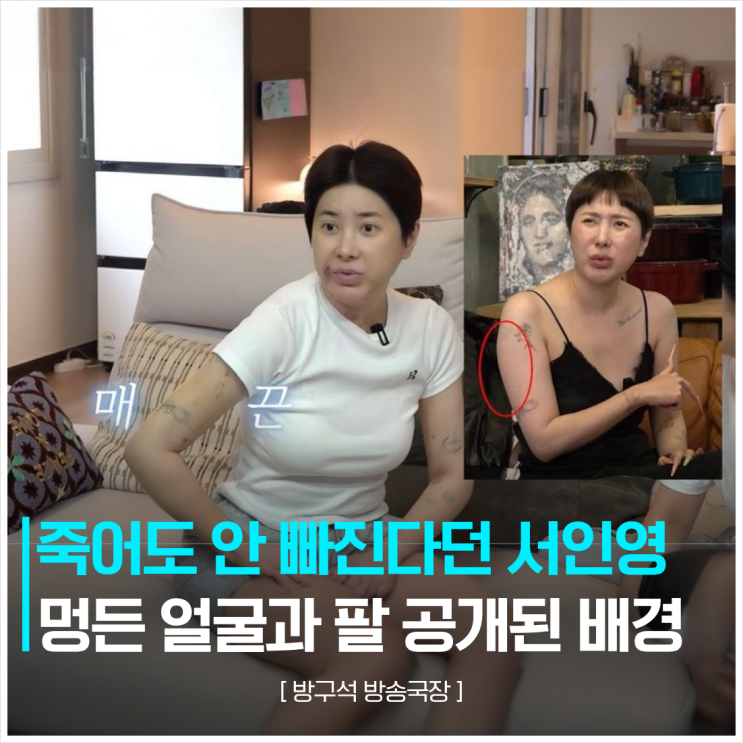 "  레이저 맞고 <b>지방흡입</b>까지 받은 '원조 신상녀' <b>서인영</b>의 고백
