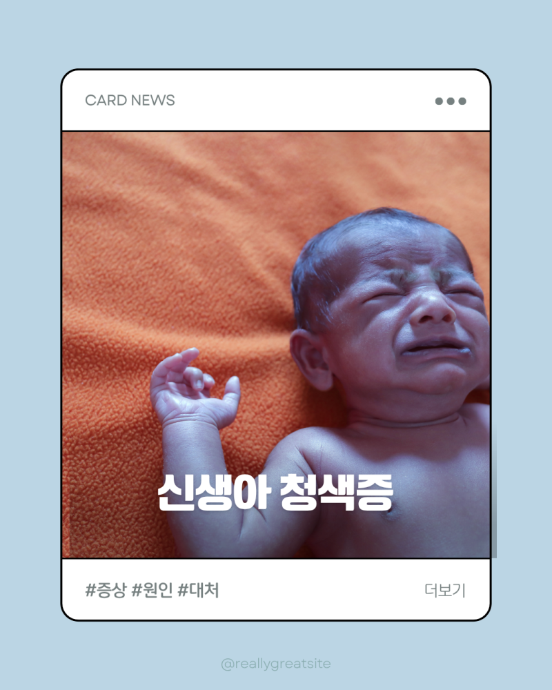 신생아 청색증 빠르게 대처해야해요