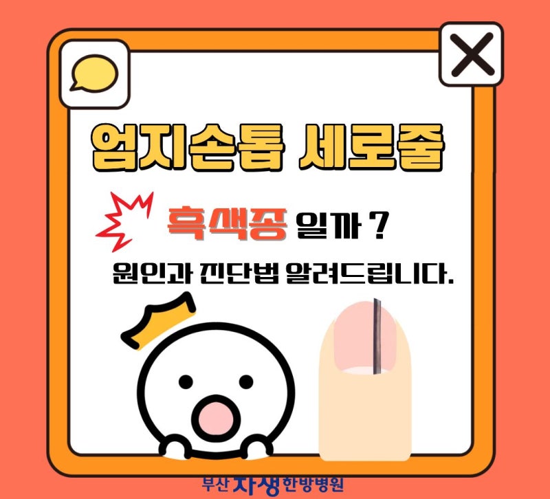 엄지손톱 세로줄 흑색종일까? 원인과 진단법 알려드립니다.
