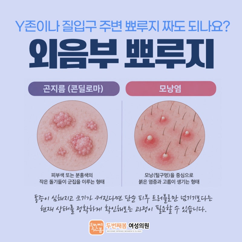 Y존 여드름·질입구 좁쌀, 손으로 짜면 안 되는 이유와 질환별 차이점