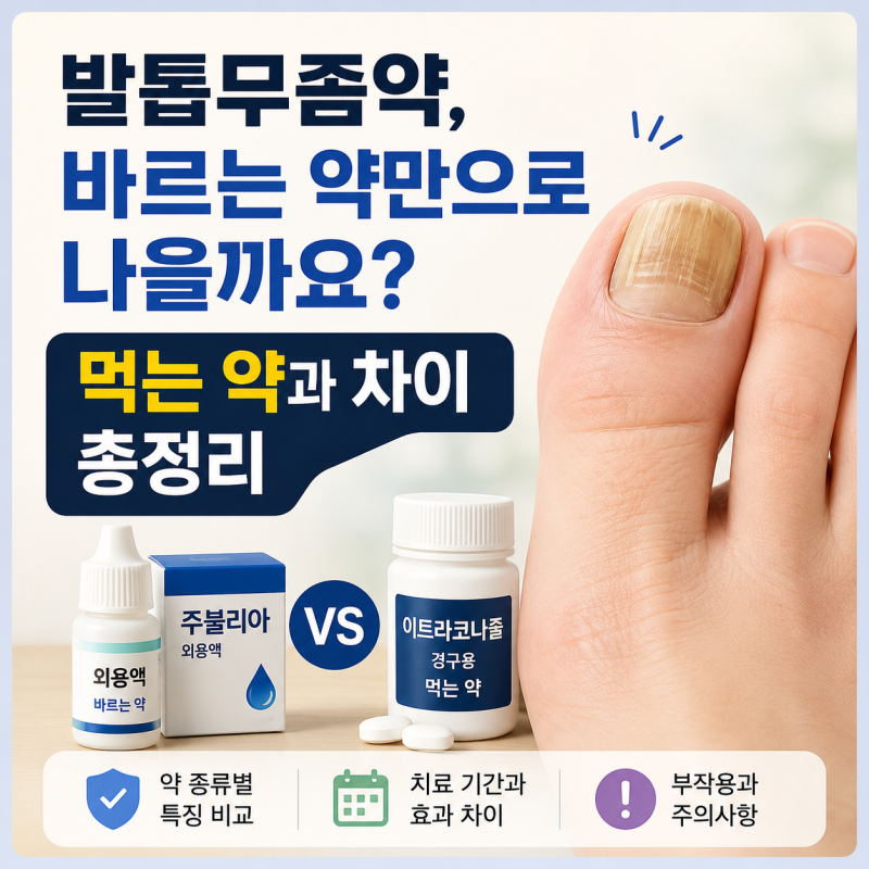 발톱무좀약, 바르는 약만으로 나을까요? 먹는 약과 차이 총정리