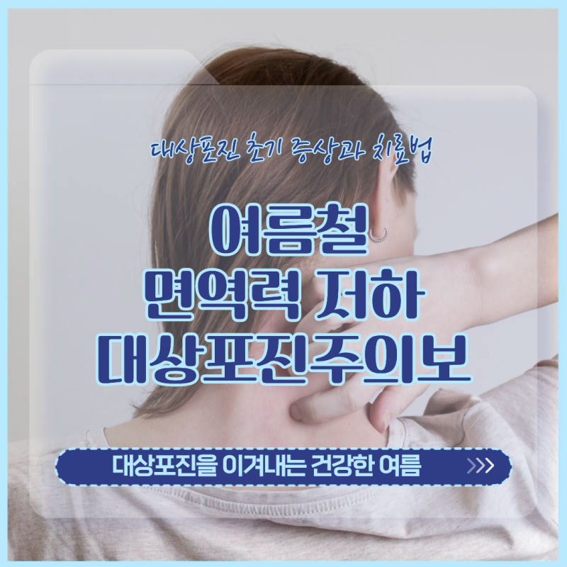 여름철 면역력 저하로 인한 대상포진 주의보
