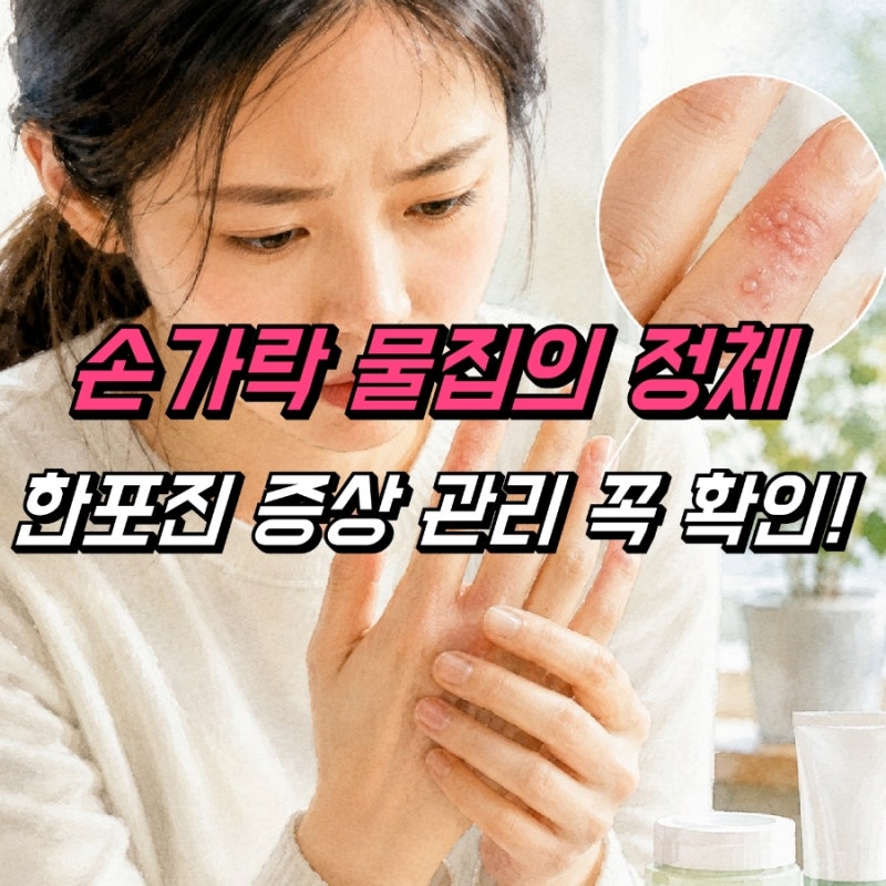 손가락 한포진 원인 치료 연고, 손가락수포 관리 방법