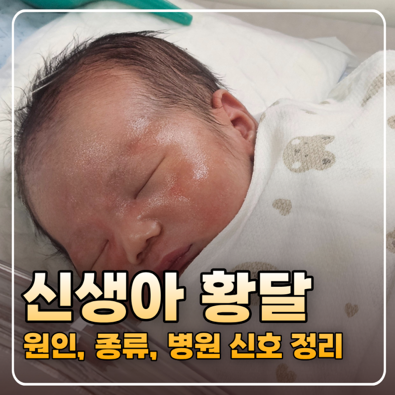 신생아 황달 언제 병원 갈까? 원인, 증상, 모유황달 정리