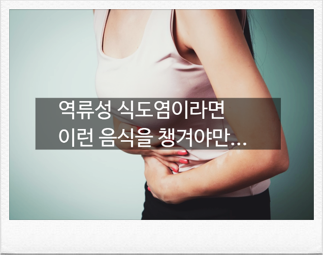 속쓰림 역류성식도염이라면, 양배추 말고 챙겨야 할 음식 Best 3