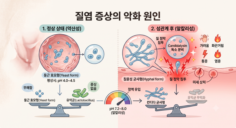 칸디다균은 상재균인데, 왜 관계 후 증상이 심해지나요?