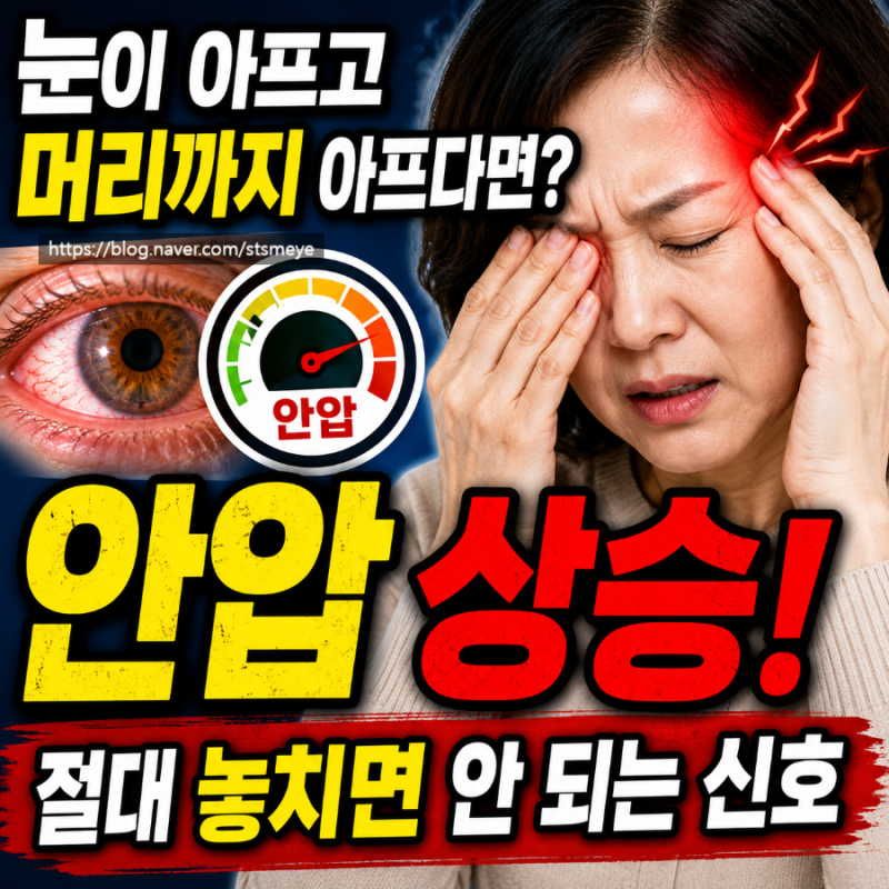송탄안과, 송탄성모안과 : 안압이 오르면 나타나는 증상!녹내장의 시작일 수도 있습니다