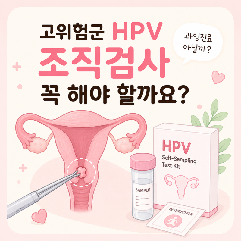 고위험군 HPV 지속감염, 조직검사 꼭 해야 할까요?