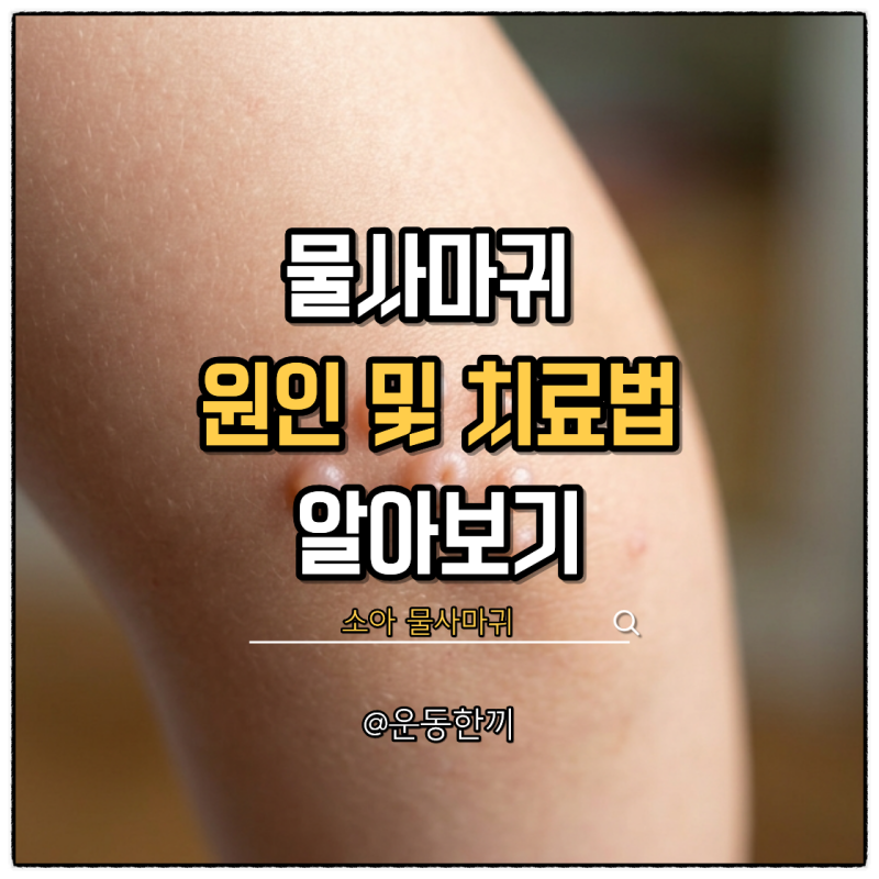 물사마귀 원인 치료 전염 관리 예방 방법 식단