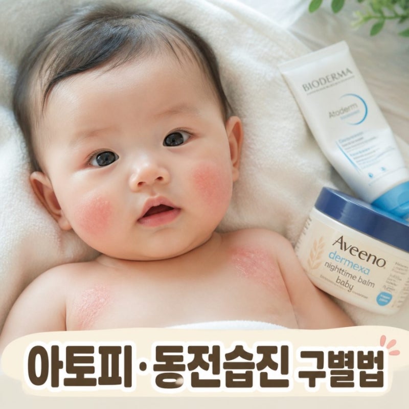 우리 아이 피부 붉은 자국, 아토피일까 동전습진일까? 차이점 총정리