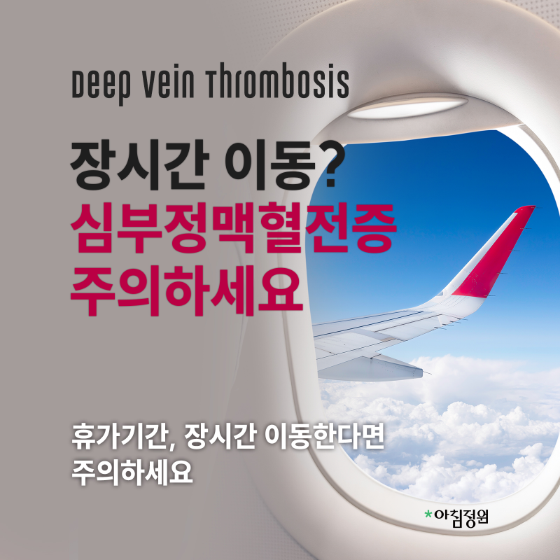심부정맥혈전증! 장거리 비행 전 꼭 알아두세요