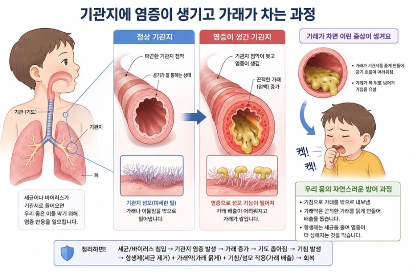 아기 밤기침, 항생제 먹는데 왜 계속할까? 기관지염 가래의 진짜 원리와 밤기침 대처법