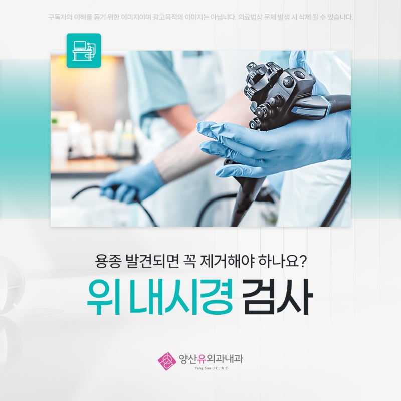 위내시경용종 발견되면 꼭 제거해야 하나요?