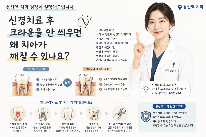 용산 신경치료 치과, 20년 치과전문의가 말한다-신경치료 후 크라운을 안 씌우면 왜치아가 깨....