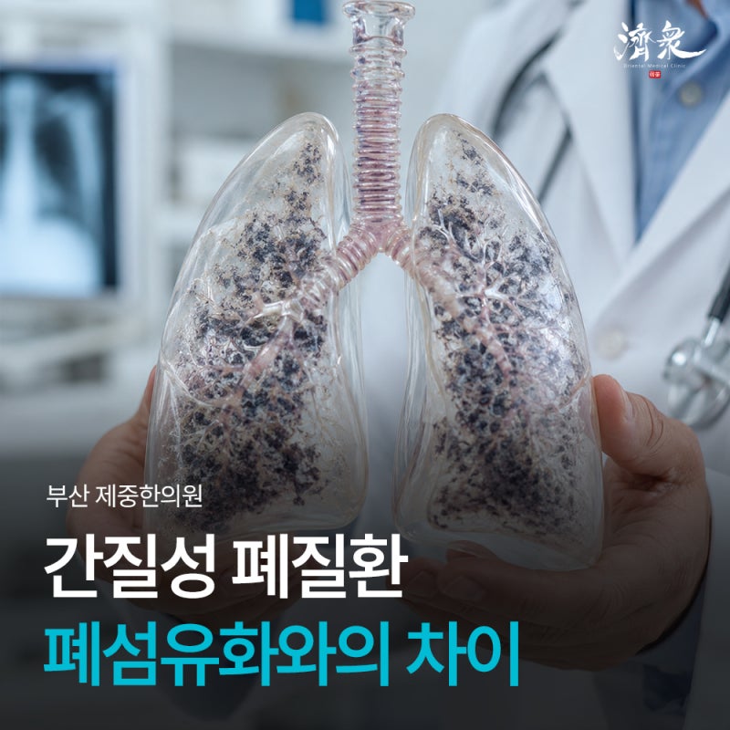 간질성폐질환 증상, 폐섬유화와 차이부터 검사 치료까지