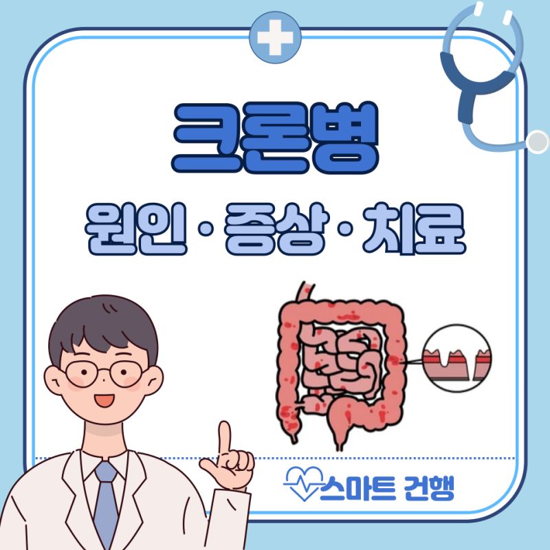 크론병 증상, 원인, 치료법, 완치 : 좋은 음식