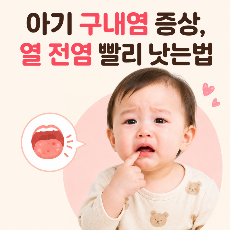 아기 구내염 증상, 열 전염 빨리 낫는법 총정리