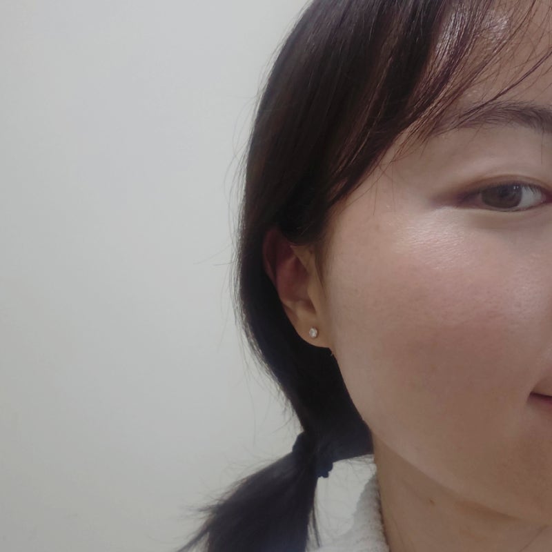 주사피부염 원인 연고 완치 치료 증상 크림