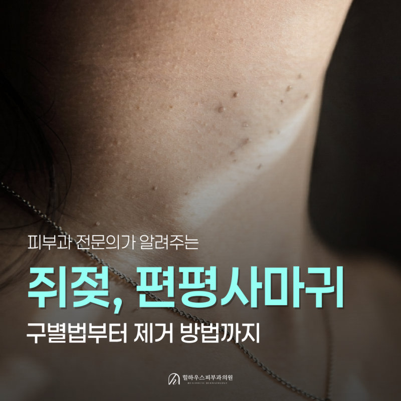 수원 피부과ㅣ목, 얼굴, 겨드랑이 쥐젖과 편평사마귀 차이, 구별법부터 제거 방법까지
