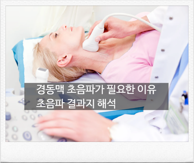 뇌졸중 예방 경동맥초음파 검사 비용, 실손보험 청구 가능 조건과 초음파 검사 결과 해석