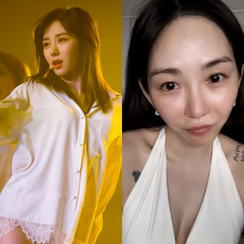 “예전 모습과 확 달라졌네” 권민아 의료사고 후 공개한 근황