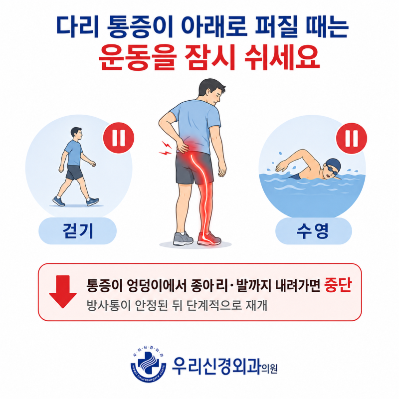 허리디스크 운동, 다리가 저리고 아플 때도 계속 걸어야 할까요?｜부산우리신경외과