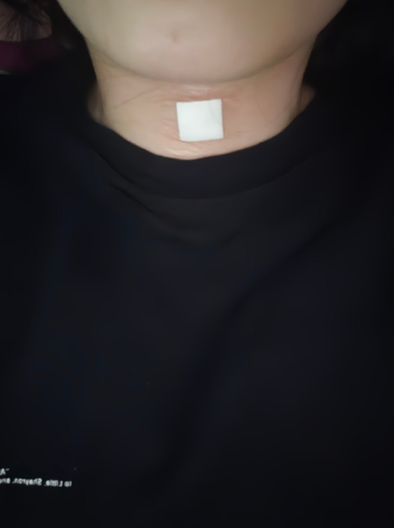 35살에 갑상선암 6단계 진단