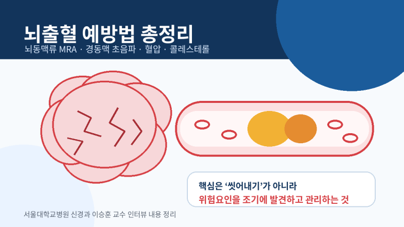 뇌출혈 예방법 총정리｜뇌동맥류 MRA 검사·경동맥 초음파·혈압·콜레스테롤 관리 (서울대병....
