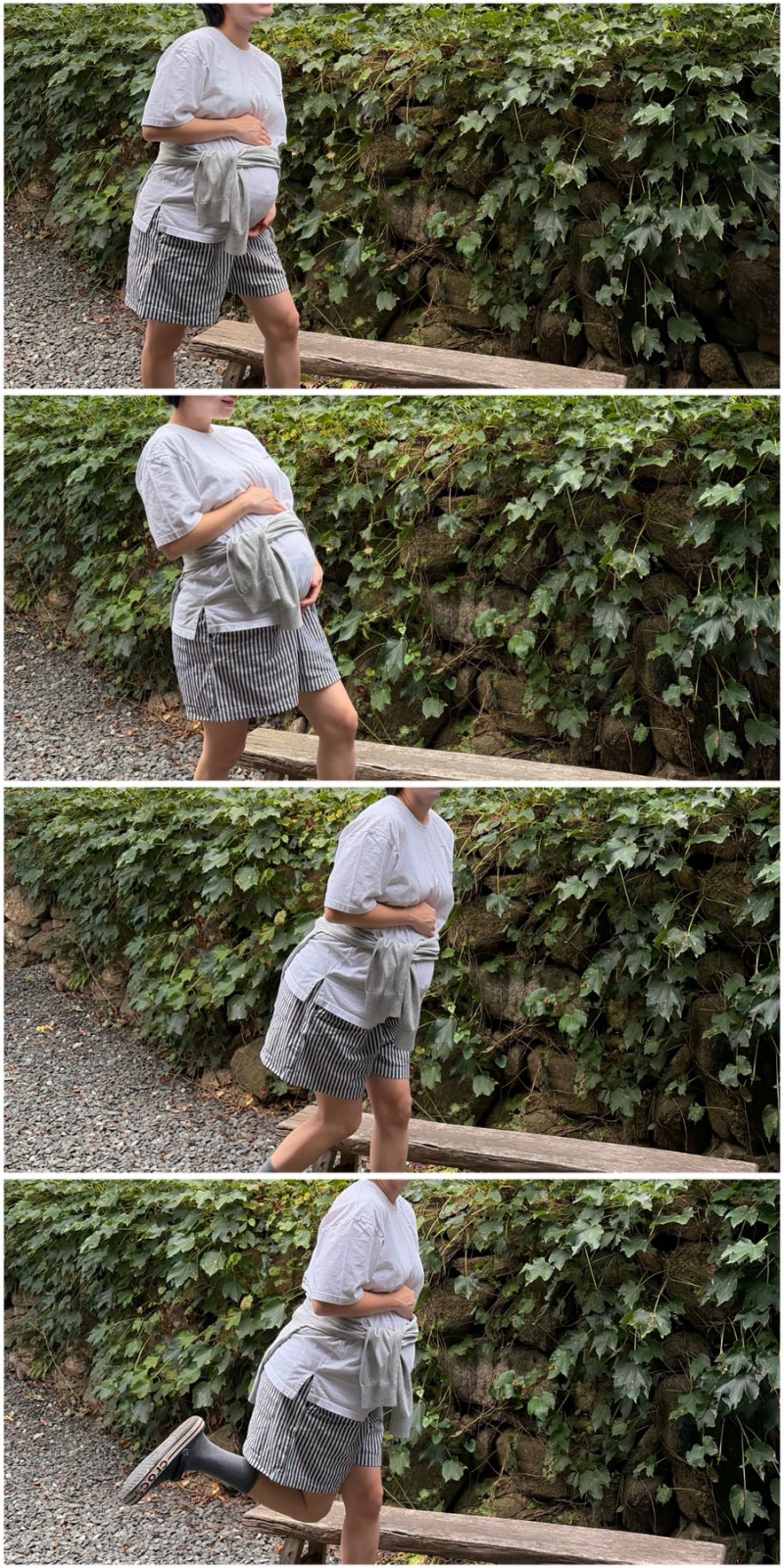 단태아에서 다태아… 일란성 쌍둥이 성별 / 태아보험 성공 ! / 2차기형아선별검사 완료 / 정밀....