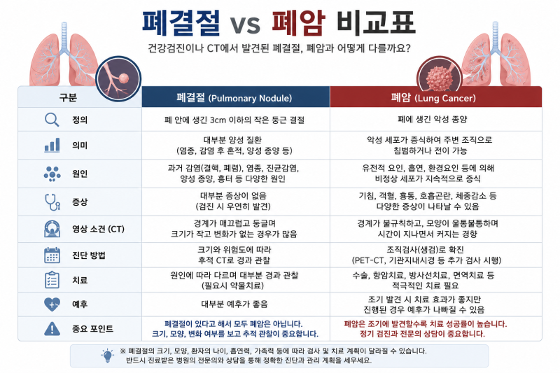 건강검진에서 '폐결절'이 발견됐습니다. 폐암인가요?