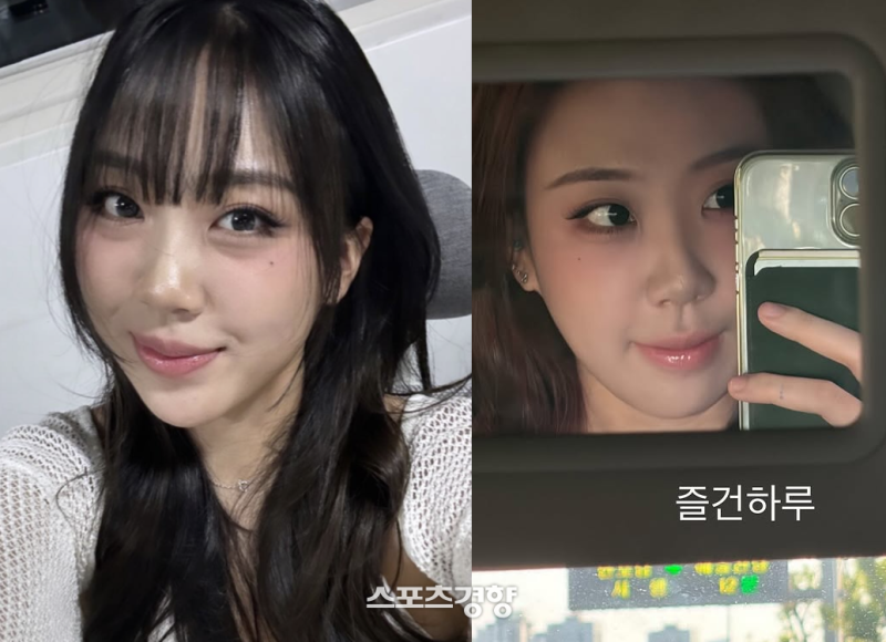 이영지 눈밑지방재배치, 시술일까 수술일까?