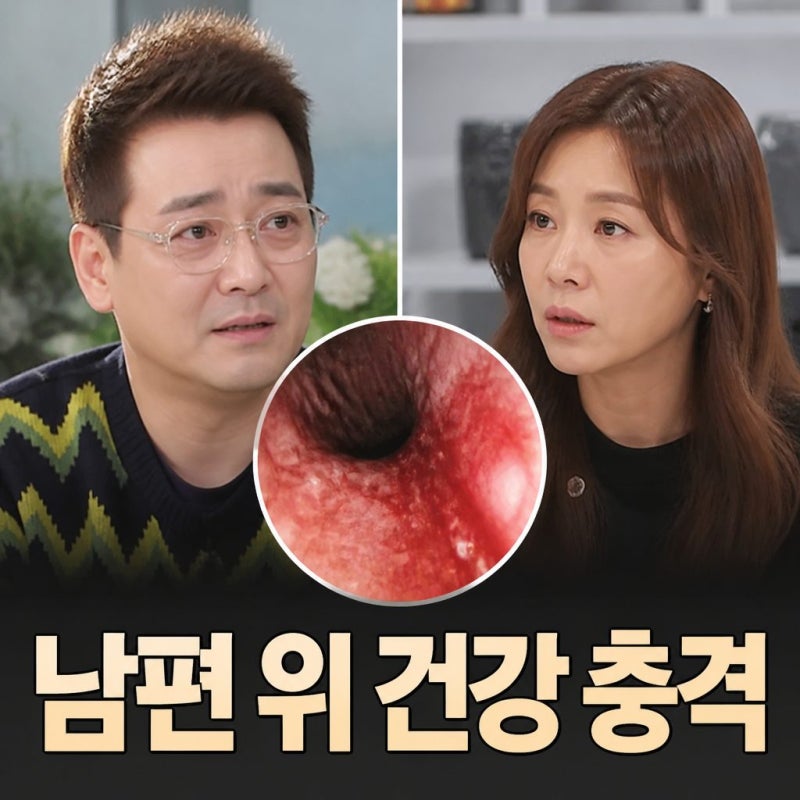 정하나 배우 위내시경 결과 공개 소주 주량 충격