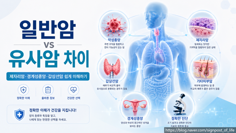 암 완전정복 시리즈 ③일반암과 유사암의 차이