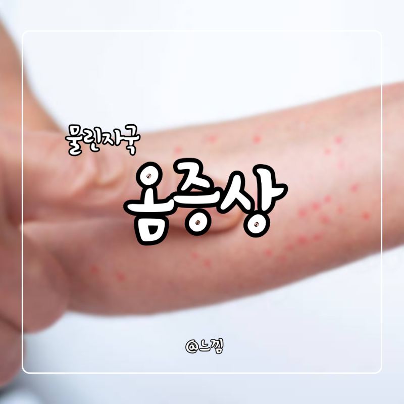 옴 증상 피부 전염 잠복기 옴치료법