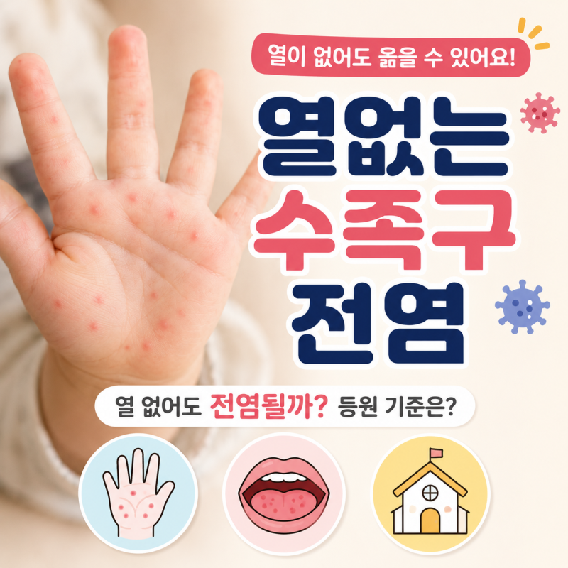 열없는 수족구 전염 될까? 열이 없어도 옮는 이유와 어린이집 등원 기준