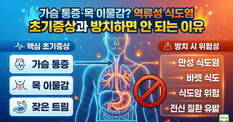가슴 통증·목 이물감? 역류성 식도염 초기증상과 방치하면 안 되는 이유