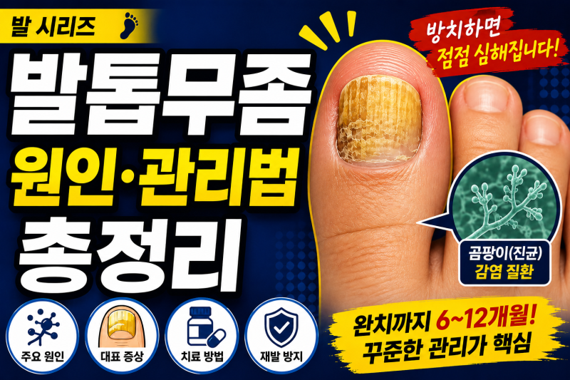 발톱무좀 원인·관리법 총정리 | 발 시리즈