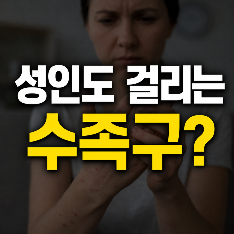 성인도 걸리는 수족구? 증상부터 치료까지 총정리