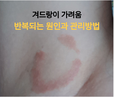겨드랑이 가려움 원인과 증상별 관리 방법