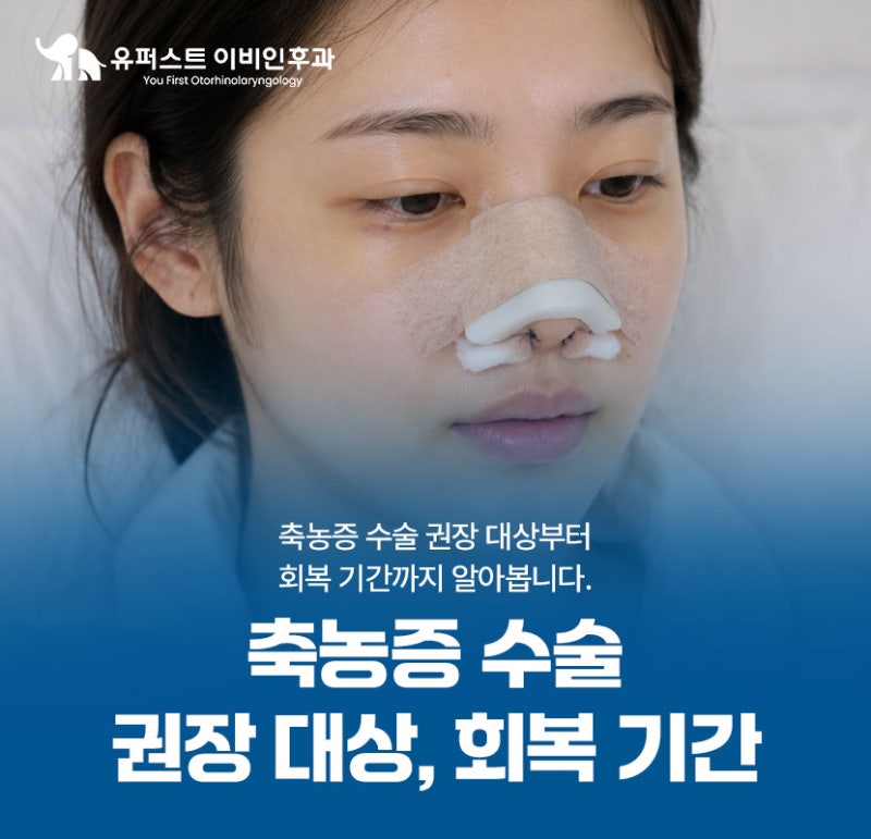 축농증수술이 필요한 기준, 권장 대상, 회복 기간은?