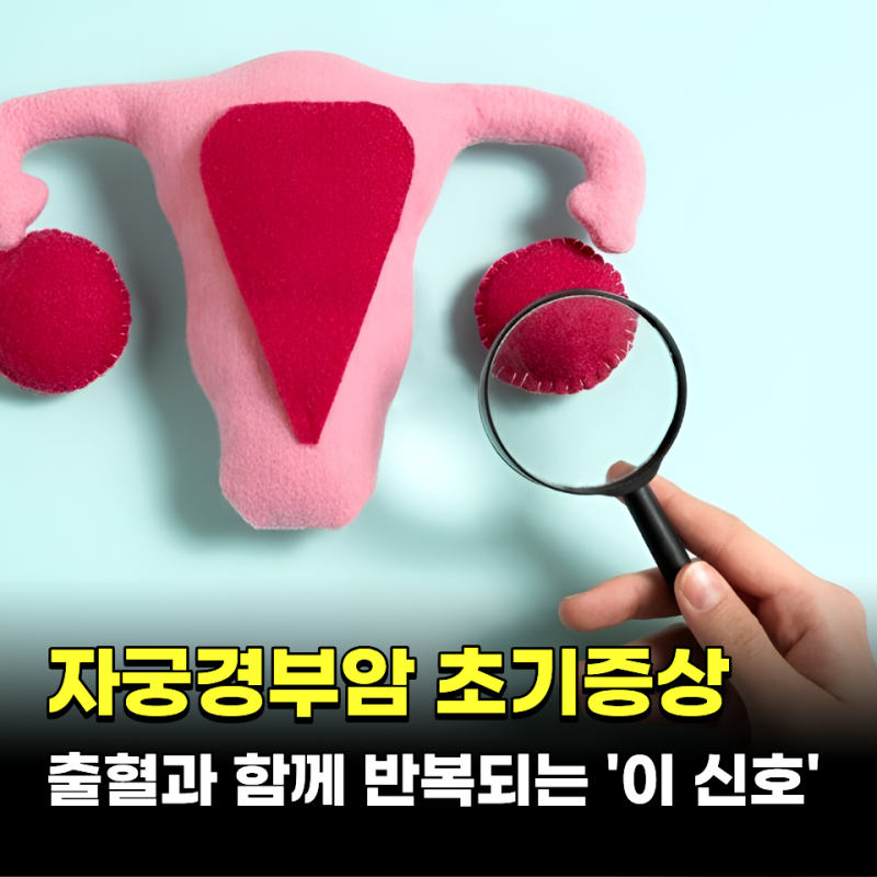 출혈과 매달 반복되는 '이 신호'.. 자궁경부암 초기증상 TOP4