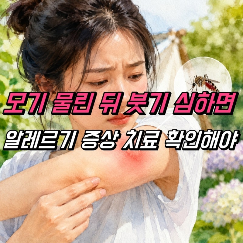 모기 물렸을때 스키터증후군 주의, 모기알레르기 약 연고